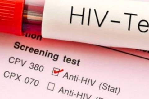 millennial hiv test hiv