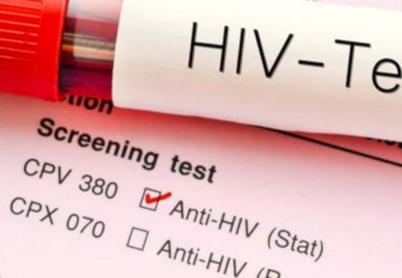 Il rifiuto degli etero al test HIV, ma sono il 40% dei nuovi casi