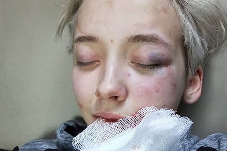 18enne lesbica picchiata da 7 uomini - Ekaterina e la sua fidanzata Alina - Gay.it