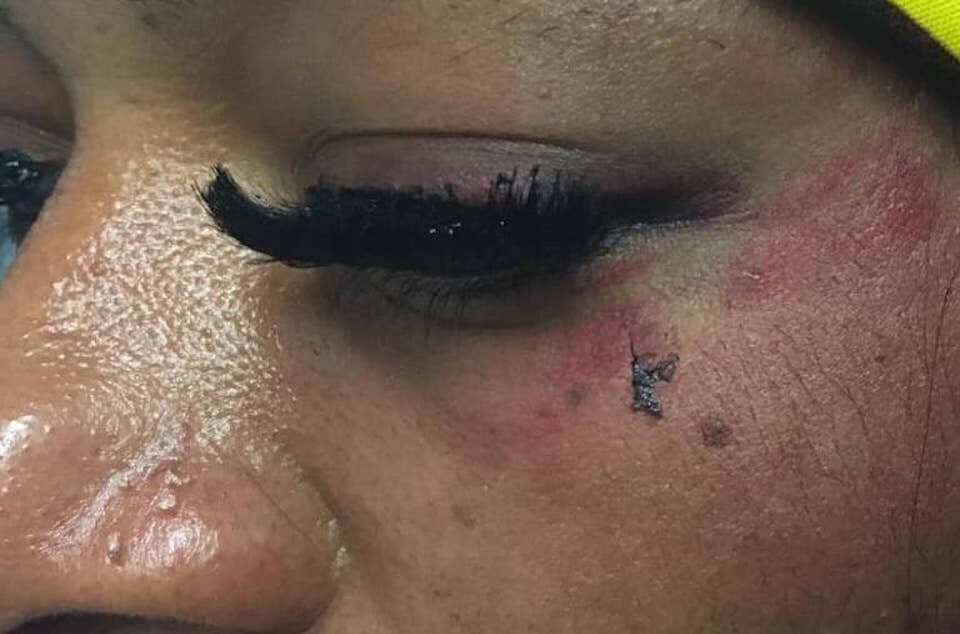 Novara, violenta aggressione omofoba ai danni di una lesbica: “Sei una vergogna, ti ucciderò”