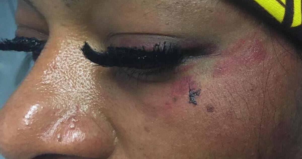 Novara, violenta aggressione omofoba ai danni di una lesbica: “Sei una vergogna, ti ucciderò”