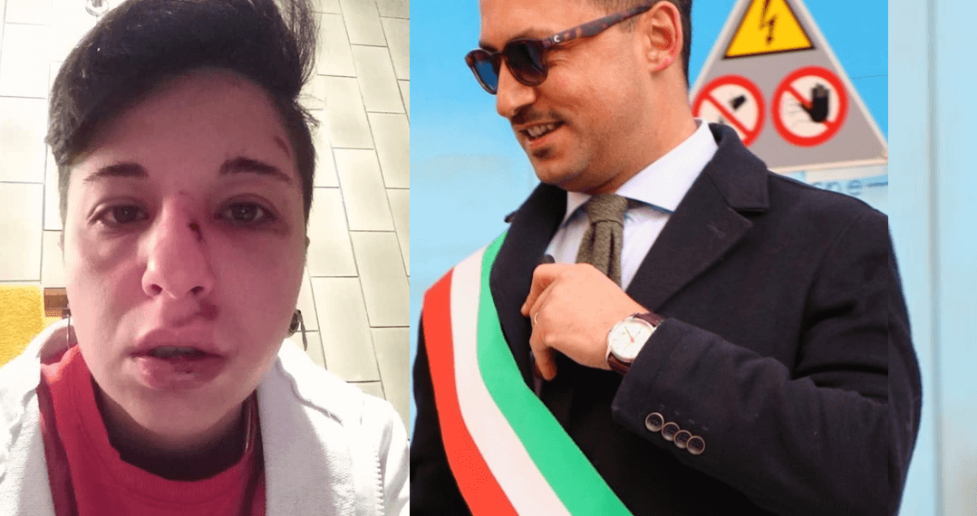 Potenza, il sindaco dopo l’aggressione omofoba: “Imbecilli da arrestare, ma il fascismo è un fantasma del passato”