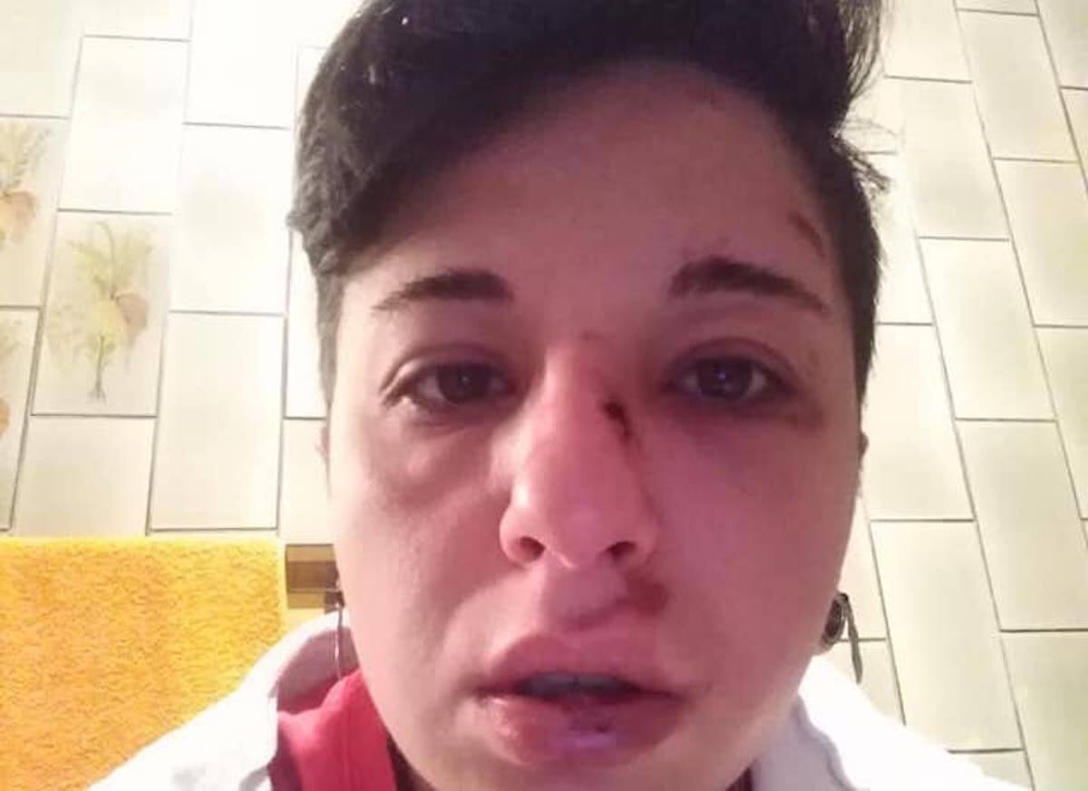 Potenza, ragazza lesbica picchiata in strada: pugni, testate e calci da due teppisti