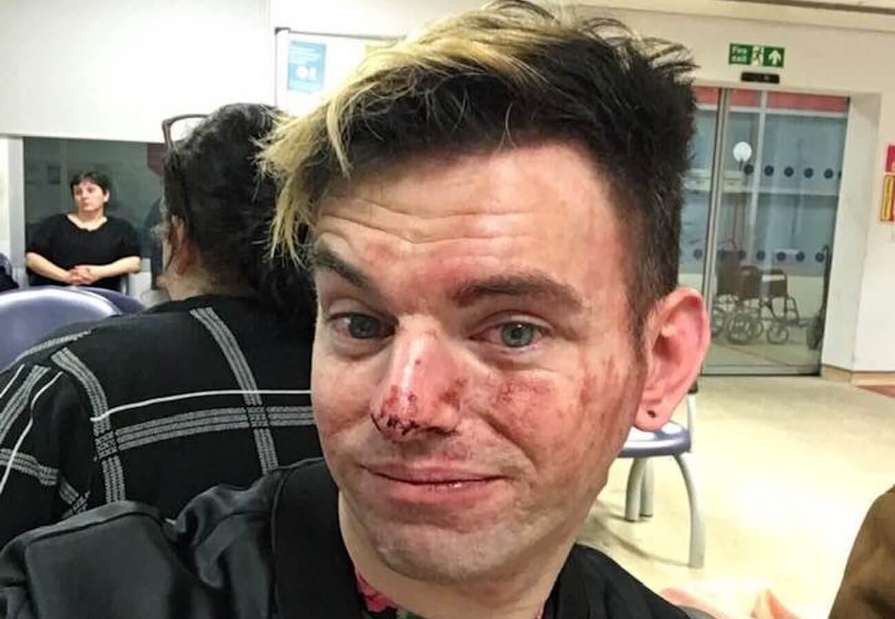 Ragazzo etero difende da un’aggressione omofoba una coppia gay e viene pestato