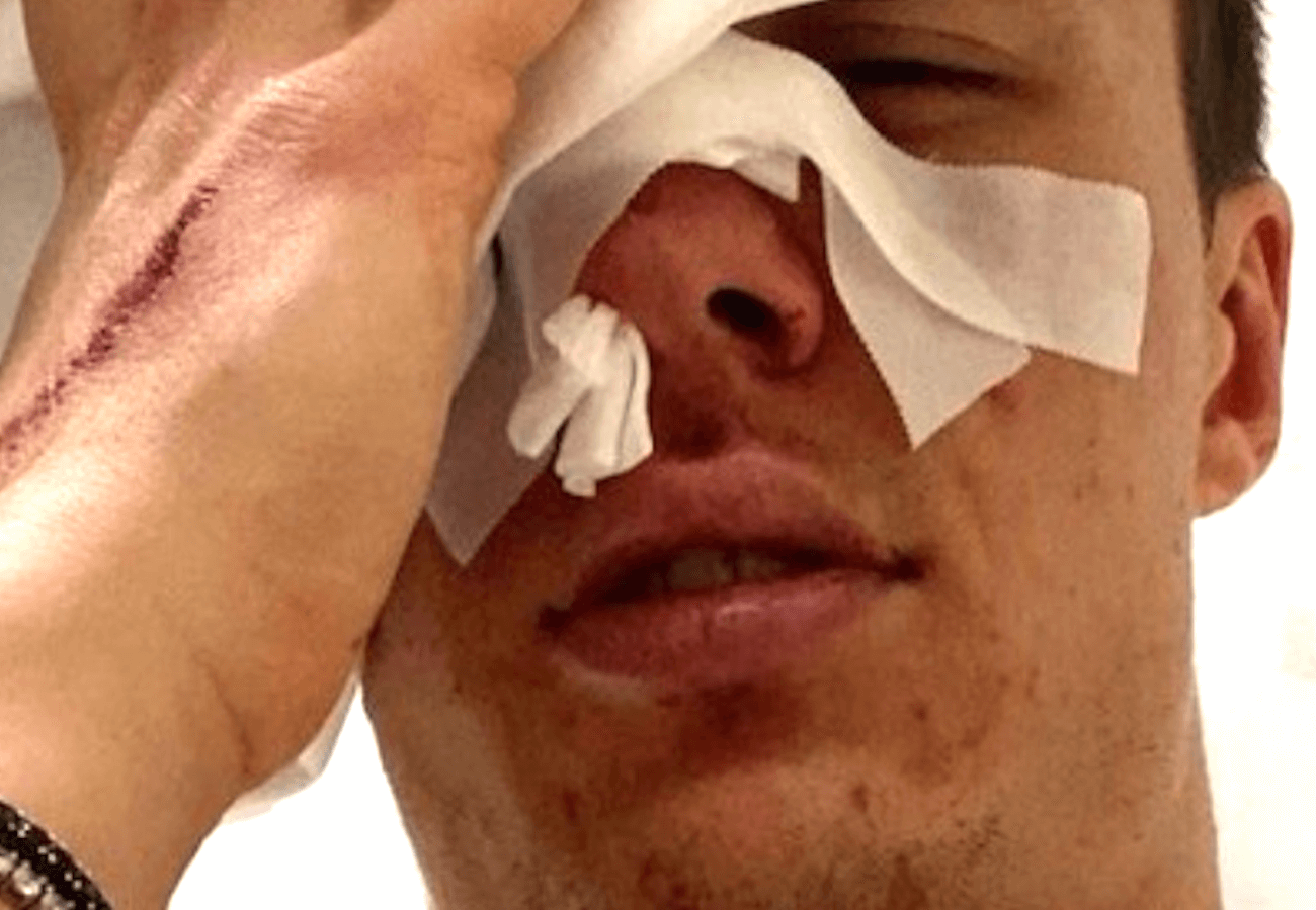 Aggressione omofoba a Cesenatico: parla il ragazzo