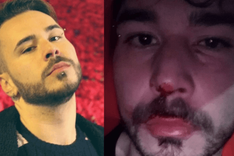 'Se stanno li a baciarsi così, danno fastidio': a Roma ragazzo gay pestato da 4 omofobi - roma omofobia - Gay.it