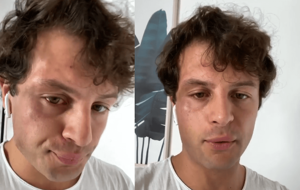 Iconize risponde alle accuse di Soleil: “Venduto per due spicci, abbiate pietà di me” (VIDEO)