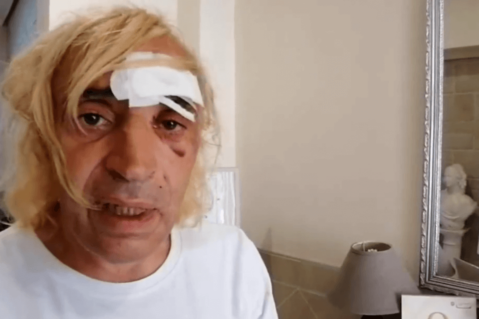Napoli, donna trans invalida presa a bastonate - la video denuncia - Napoli donna trans invalida presa a bastonate - Gay.it