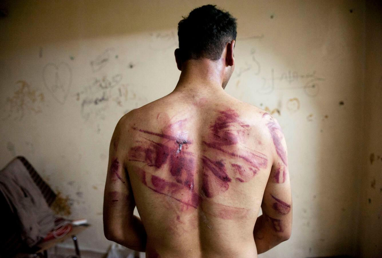 Siria LGBT: torture all’ordine del giorno – lo scioccante resoconto