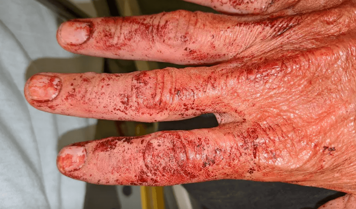 Attivista gay e suo marito brutalmente picchiati in strada