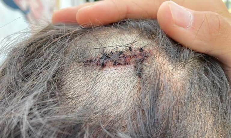 Padova, coppia gay aggredita da 6 persone per un bacio: 5 punti di sutura in testa - VIDEO - 119909203 3883512381675811 2783725875970800162 n - Gay.it