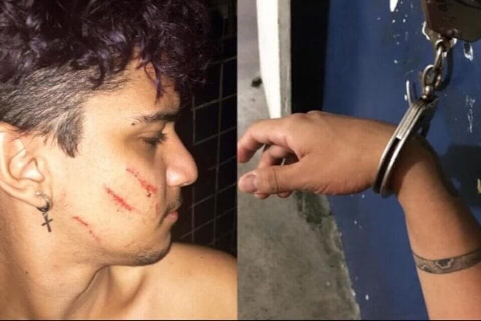 21enne picchiato dai vicini perché gay e incredibilmente arrestato dalla polizia - Gay brasiliano picchiato dai vicini e arrestato dalla polizia - Gay.it