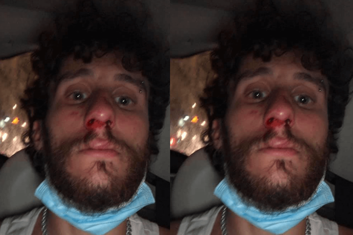 Napoli, ragazzo aggredito da 10 persone: “mi urlavano fr*cio, ma questo sono io e sono fiero di esserlo”