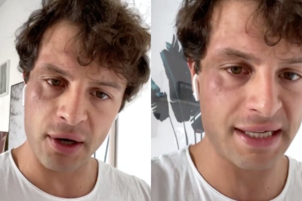 GF Vip 5, Iconize accusato di aver simulato l'aggressione omofoba. Lui: "Li denuncio" - VIDEO - Iconize aggredito - Gay.it