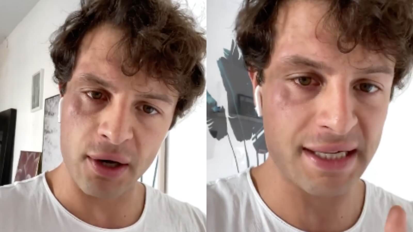 GF Vip 5, Iconize accusato di aver simulato l’aggressione omofoba. Lui: “Li denuncio” – VIDEO