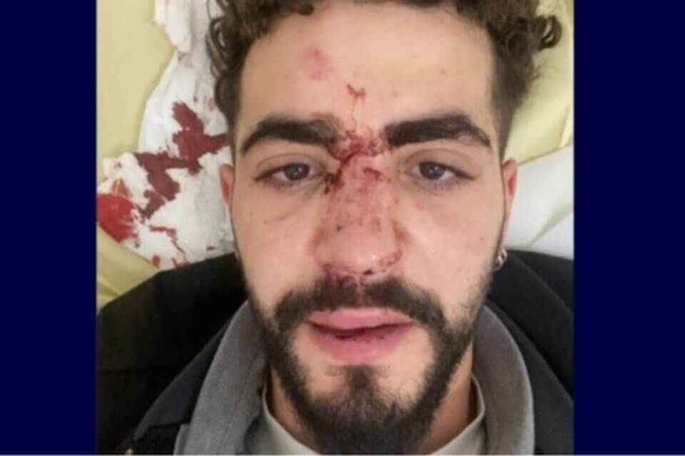 Autista Uber caccia ragazzo dall'auto perché gay e poi lo picchia - Ragazzo gay picchiato da autista Uber 1 - Gay.it
