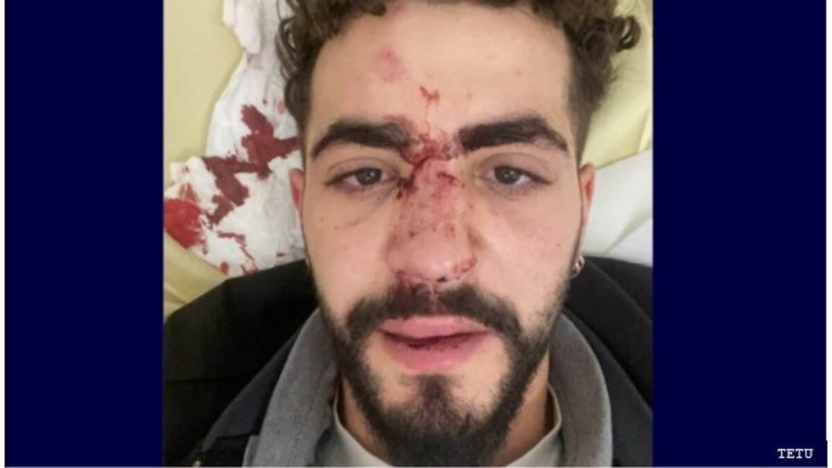 Autista Uber caccia ragazzo dall’auto perché gay e poi lo picchia