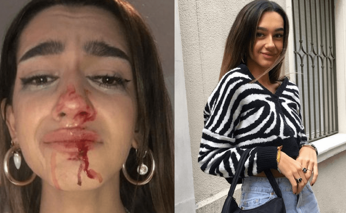 Eva, 19enne trans presa a pugni e calci in strada: “Ho gli stessi diritti di chiunque altro, non voglio morire”