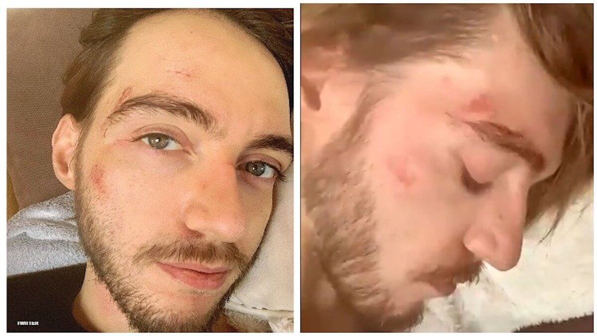 Ragazzo aggredito perché gay ha il terrore di denunciarlo alla polizia: “Mi hanno già umiliato”