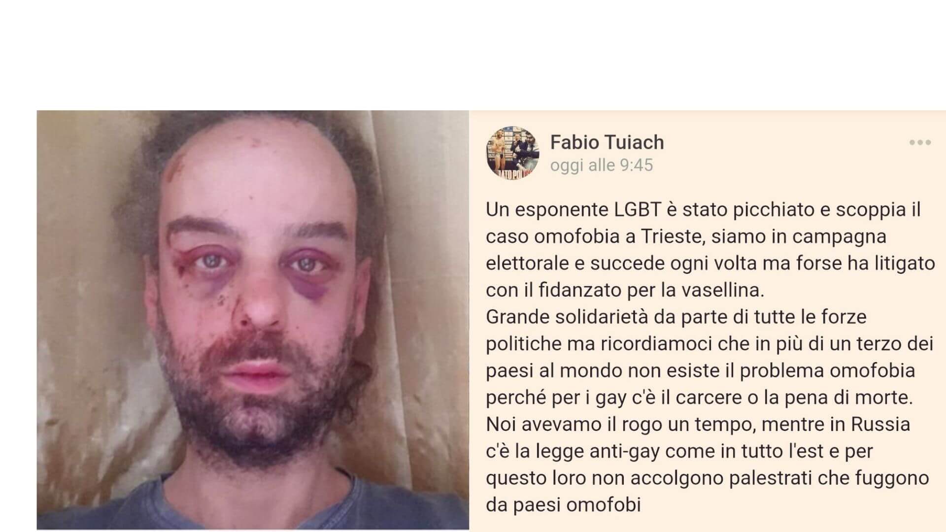Fabio Tuiach denunciato dai Sentinelli di Milano per incitamento all'odio sulla base dell’orientamento sessuale - Omofobia Trieste - Gay.it