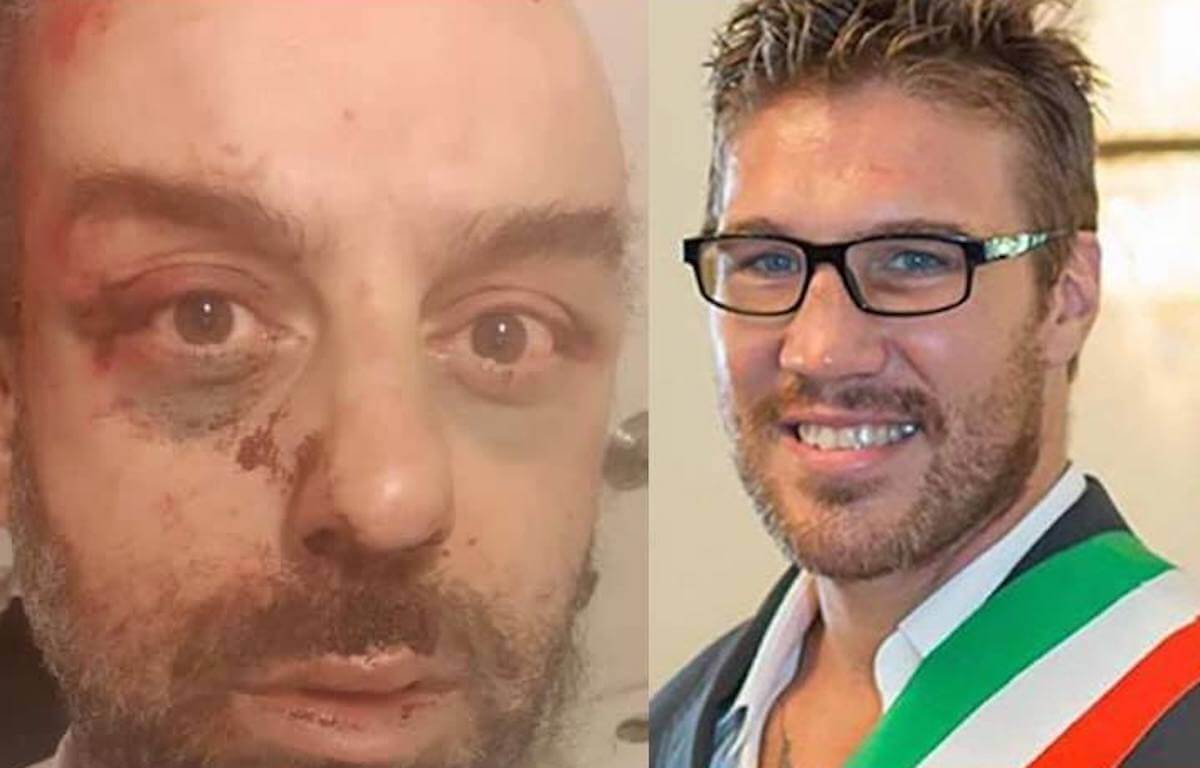 Pestaggio omofobo a Trieste, Tuiach choc: “altrove il problema non esiste perché per i gay c’è la pena di morte”