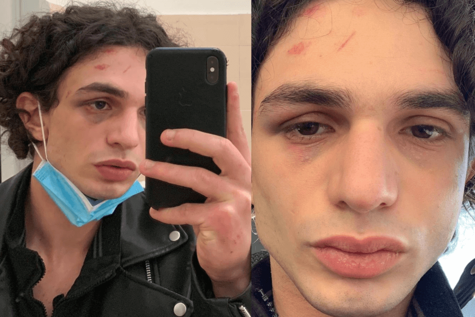 12 contro 1: nuova violentissima aggressione a Vicenza - Andrea Casuscelli - Gay.it