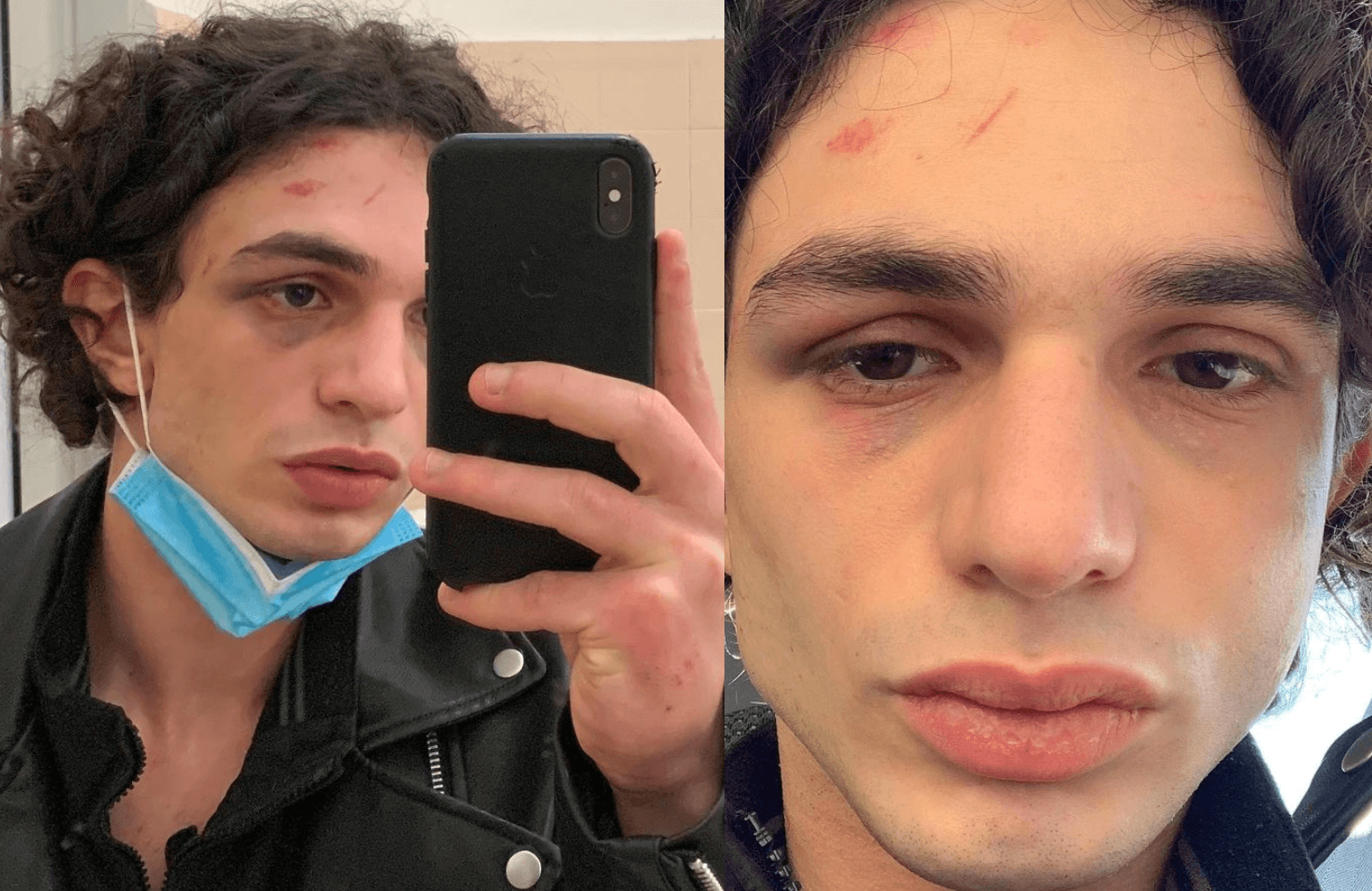 Omotransfobia in Italia, un 2021 terrificante: 70 denunce in 7 mesi solo da noi riportate - Andrea Casuscelli - Gay.it