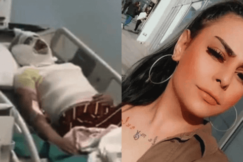 Turchia, 18enne trans aggredita con l'acido: ha perso un occhio ed è vittima di transfobia in ospedale - Asya Ceyahir - Gay.it