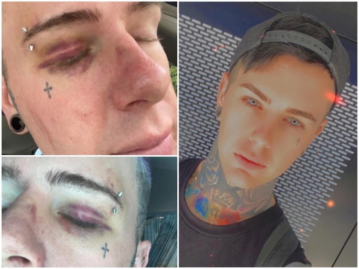 Coppia gay aggredita all’Auckland Pride 2021: si è risvegliata in una pozza di sangue