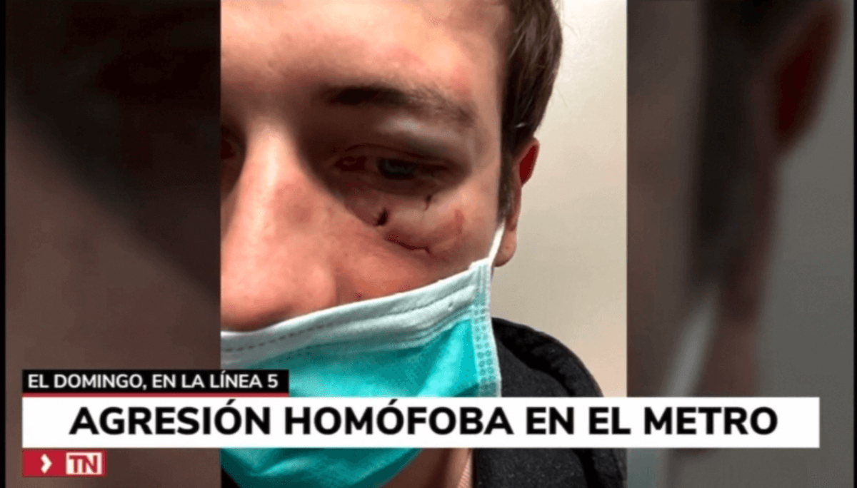 Madrid, brutale aggressione omofoba in metro al grido "fr*cio" - Madrid brutale aggressione omofoba - Gay.it
