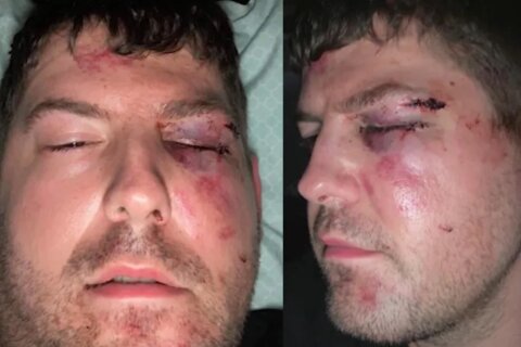 Coppia gay brutalmente picchiata in un parcheggio: camminavano abbracciati - missouri gay couple hate crime copia - Gay.it