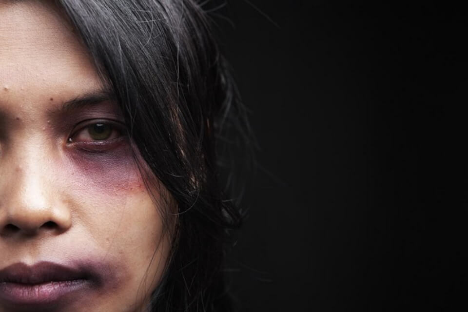 Ancona, pugni in faccia e insulti omofobi a una 16enne: stringeva la mano di un’amica