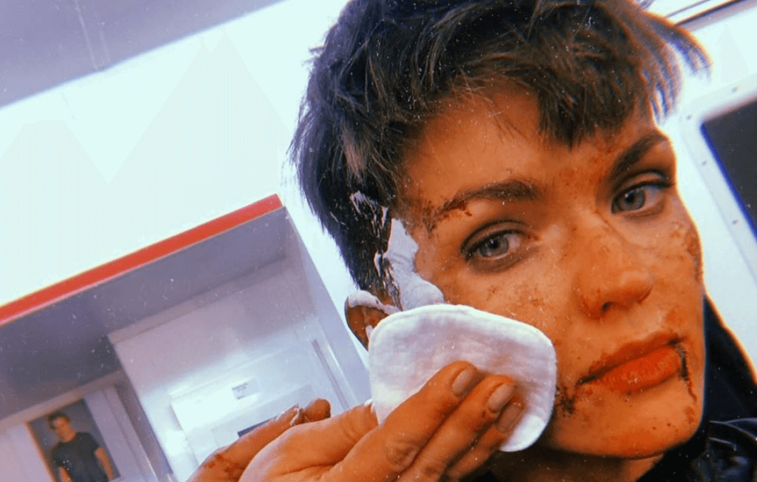Ruby Rose confessa: “mi ricoverarono in ospedale dopo un’aggressione omofoba”