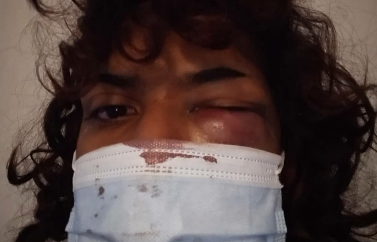 Catania, 21enne trans presa a pugni in piazza: “Senza alcun motivo apparente, nessuno è intervenuto”