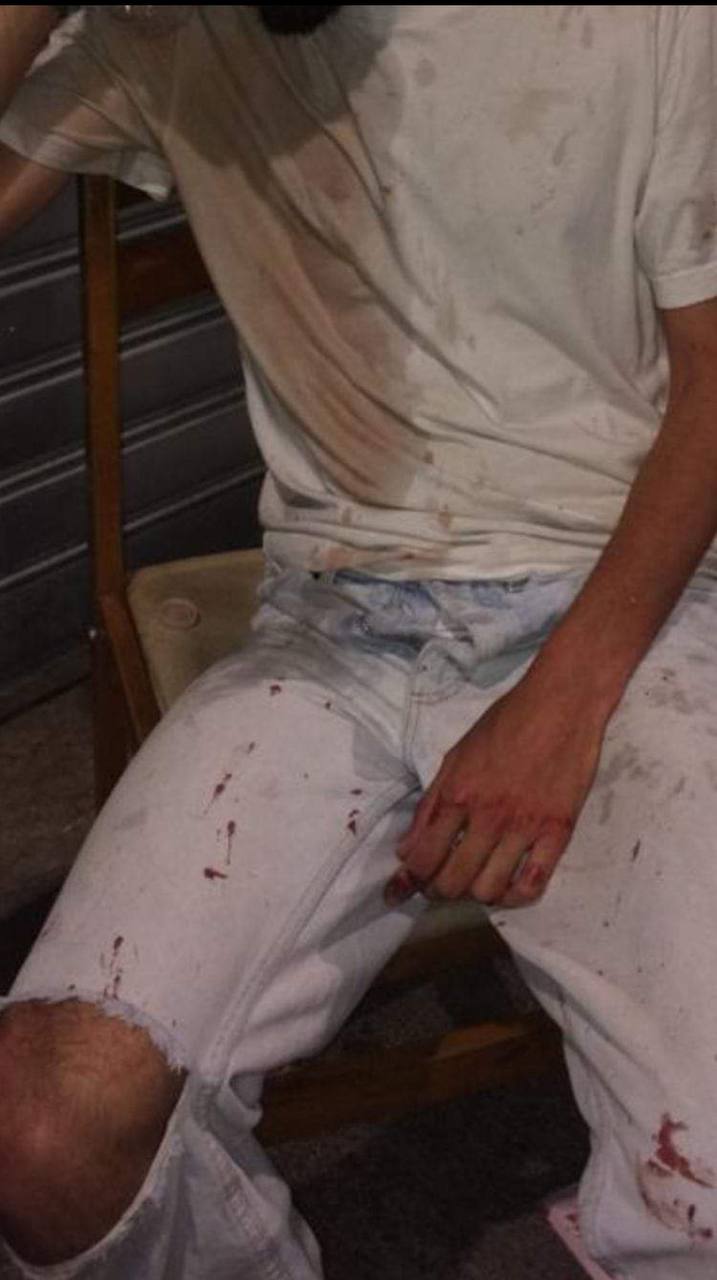 Albergatore di Palermo alla coppia gay aggredita: "Alloggio gratuito per la vostra vacanza" - palermo aggressione gay - Gay.it