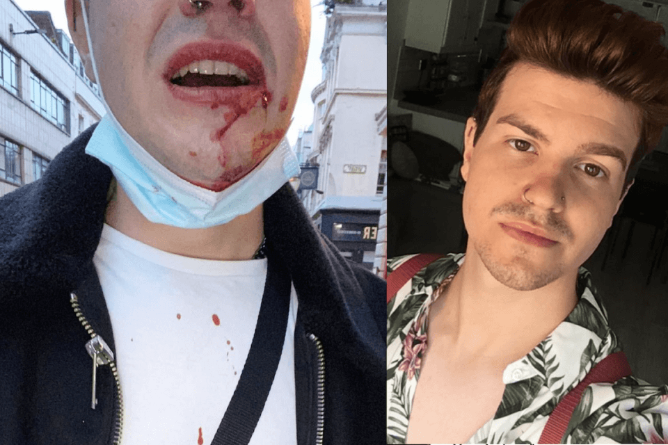 Aggredito con un coltello mentre era con il fidanzato: "Ti uccido, fr*cio" - Aggredito con un coltello mentre era con il fidanzato - Gay.it