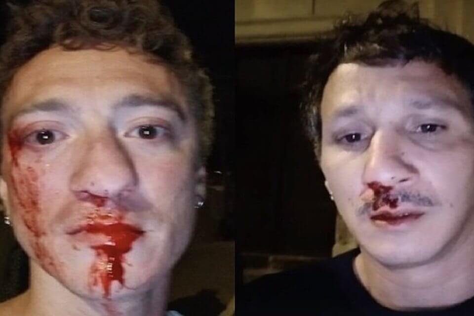 Coppia gay pestata a sangue in Corsica da 20 persone - Coppia gay pestata a sangue in Corsica da 20 persone - Gay.it