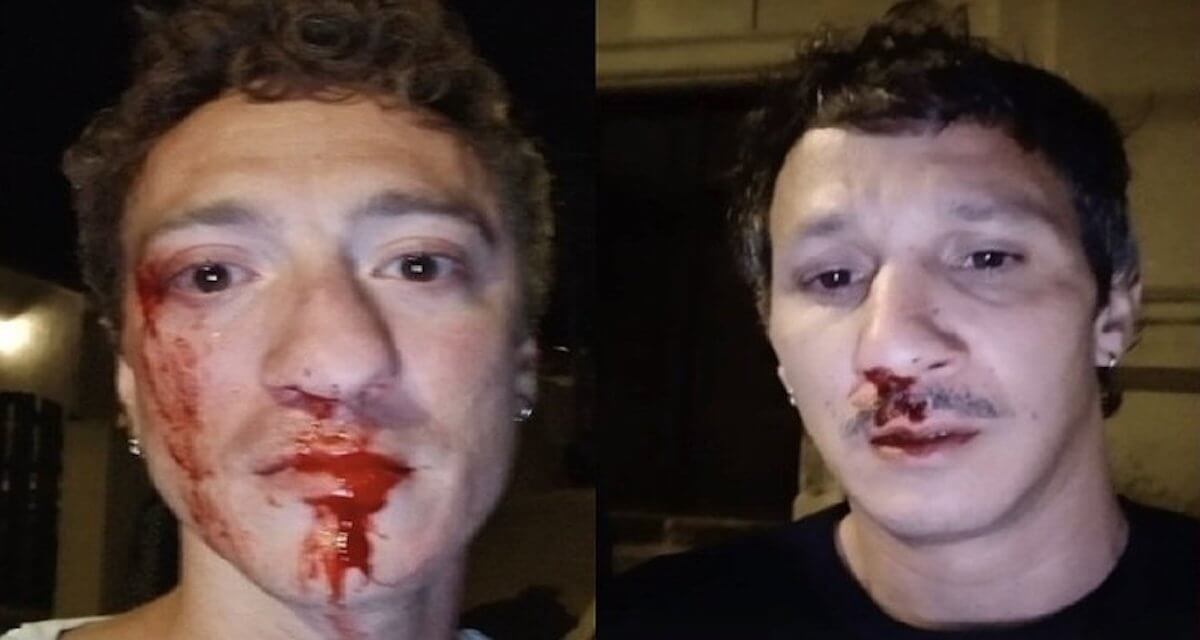 Coppia gay pestata a sangue in Corsica da 20 persone