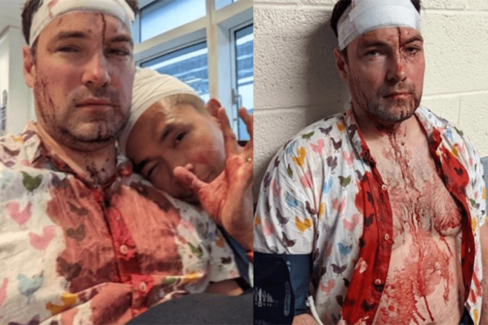 Ancora omofobia nel Regno Unito, coppia gay rapinata e pestata a sangue