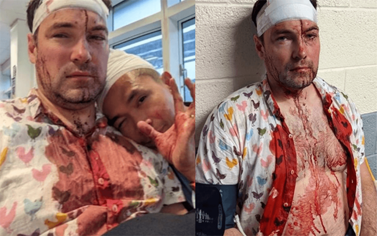 Ancora omofobia nel Regno Unito, coppia gay rapinata e pestata a sangue