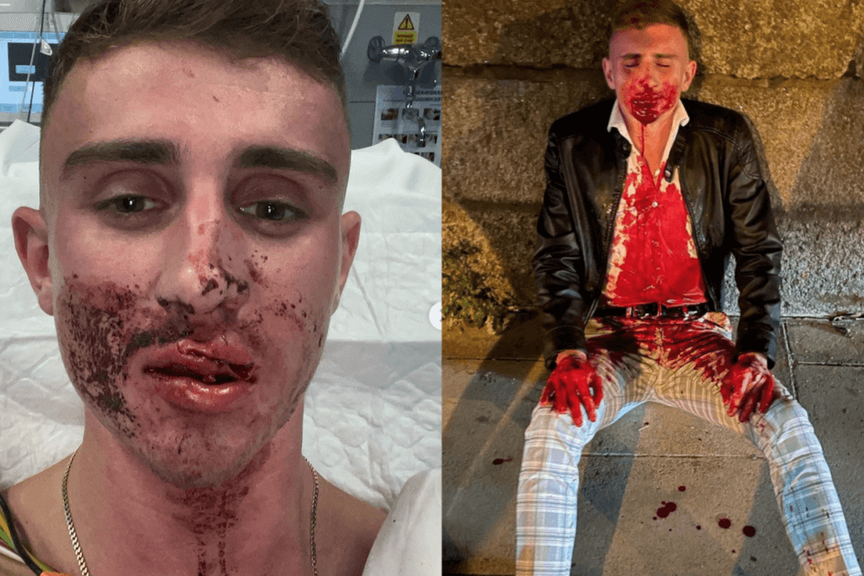 L'olimpionico irlandese Jack Woolley, gay dichiarato, aggredito da 12 persone - Jack Woolley - Gay.it