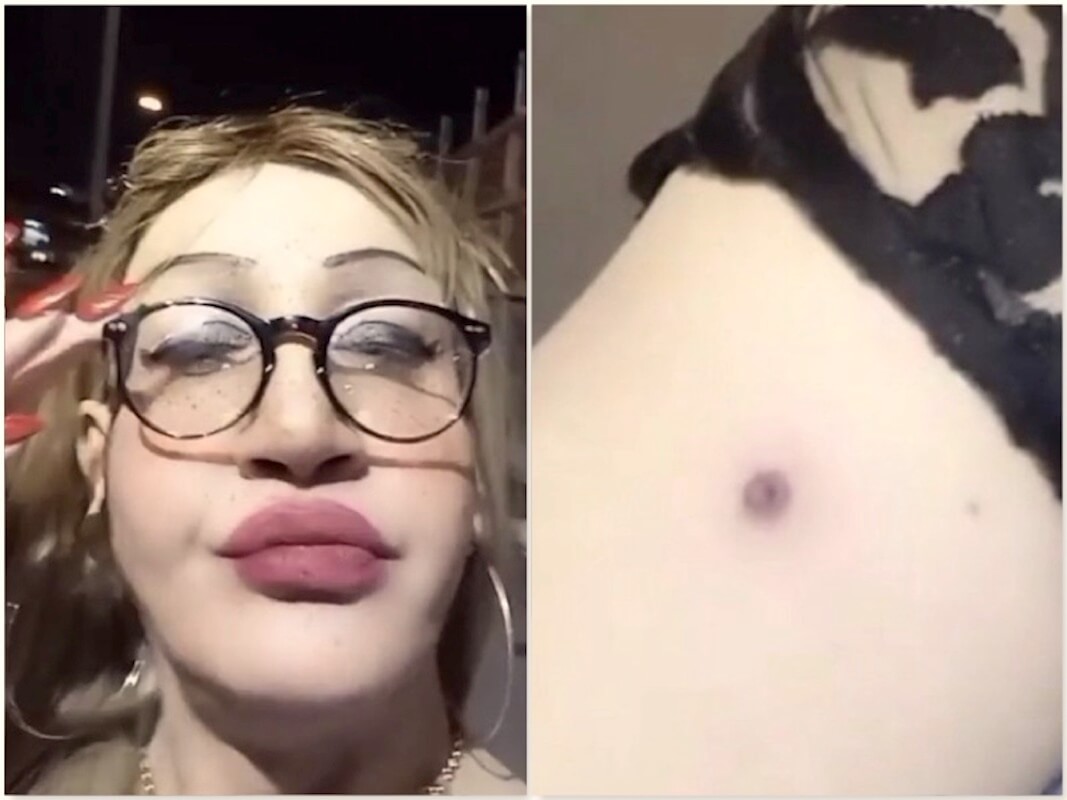 Pompei, banda di ragazzini spara ad una donna trans
