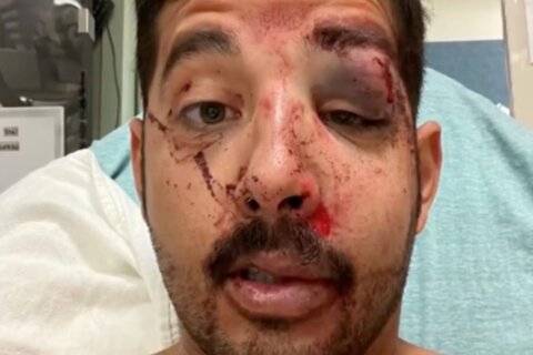 Pestato a sangue perché gay: "Non pensi mai che possa succedere proprio a te" - Pestato a sangue - Gay.it