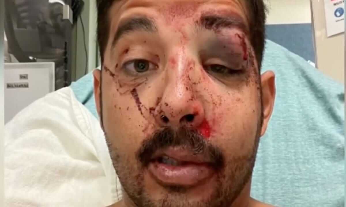 Pestato a sangue perché gay: “Non pensi mai che possa succedere proprio a te”