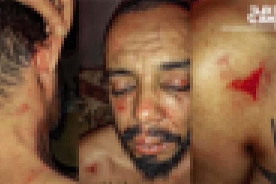 Attivista LGBTQ+ tunisino brutalmente picchiato da agenti di polizia: “Hanno minacciato di uccidermi”