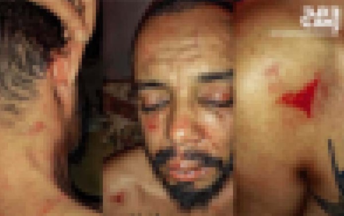 Attivista LGBTQ+ tunisino brutalmente picchiato da agenti di polizia: “Hanno minacciato di uccidermi”