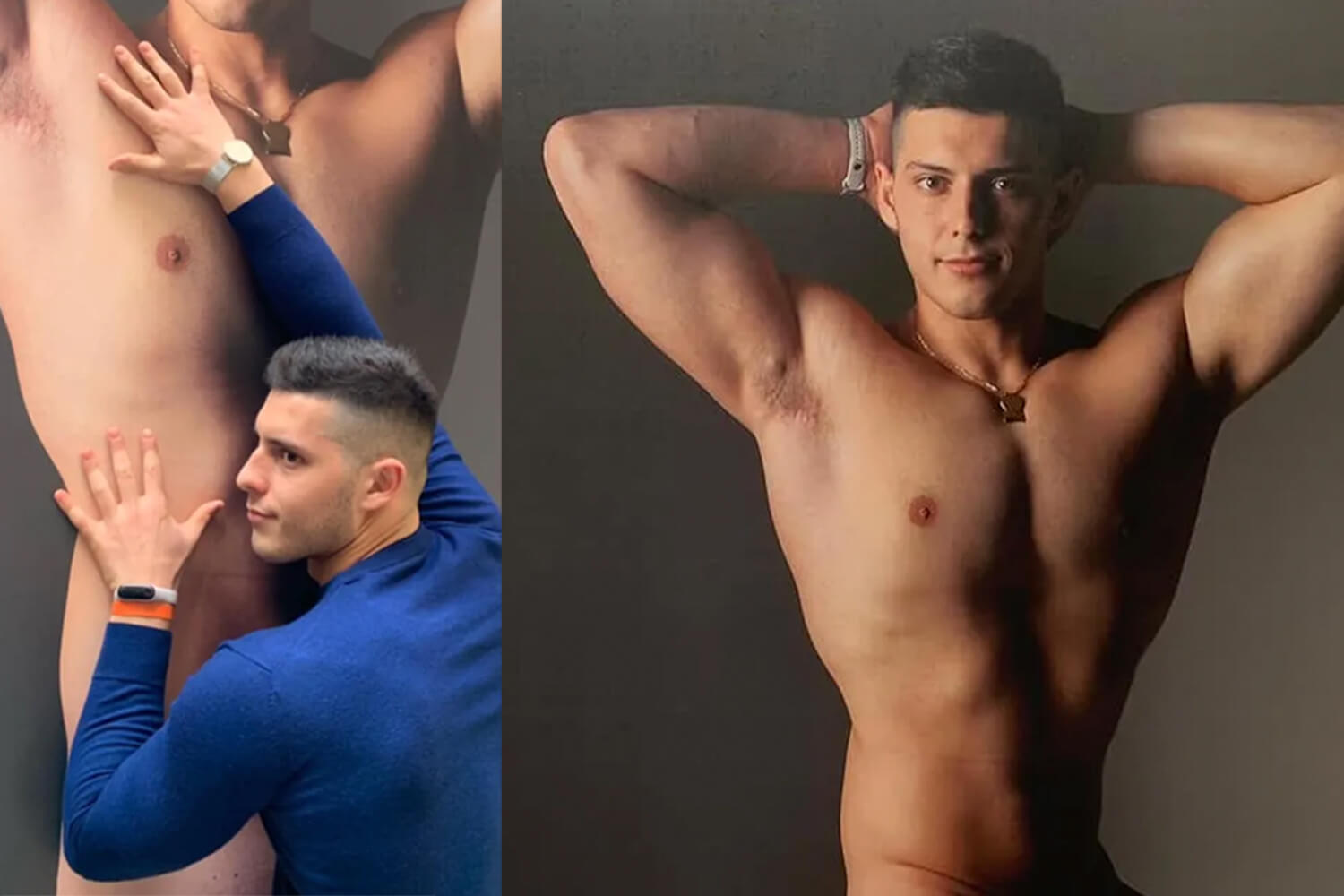 Censurati il nudo di Donato Telesca e le sue cicatrici nello scatto di Oliviero Toscani