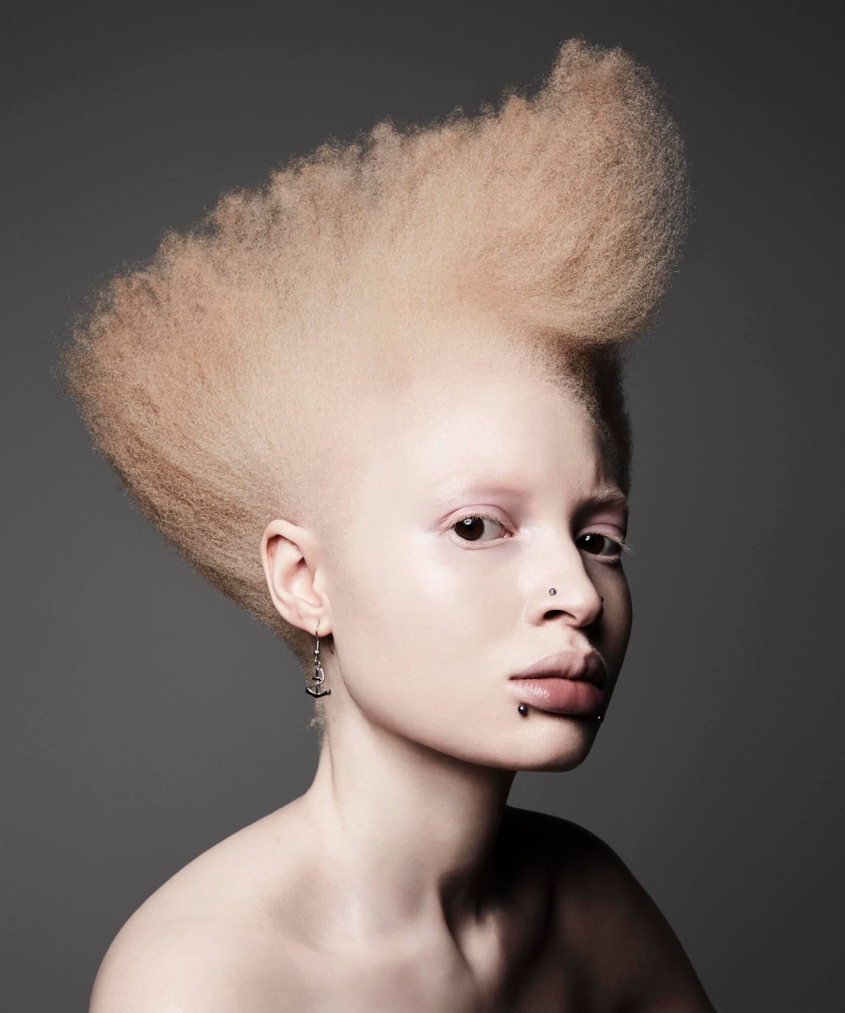 Zebedee Management modell albinismo no binary