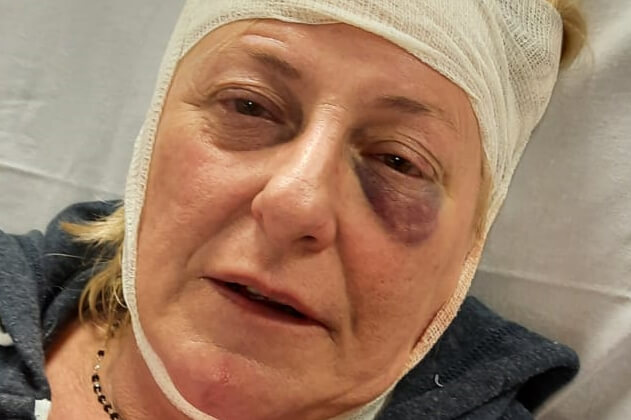 “Lesbica di m*rda” e la picchia, aggressione omofobica ad Alessandria