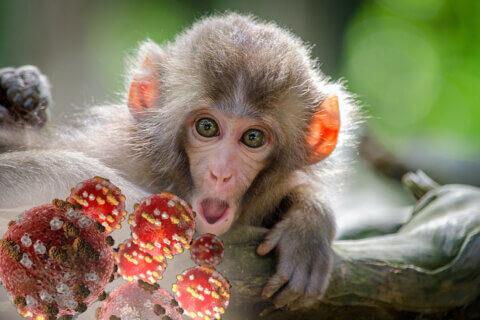 vaiolo delle scimmie gay.it monkeypox